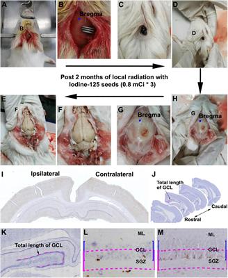 Extracranial 125I Seed Implantation Allows Non-invasive Stereotactic Radioablation of Hippocampal Adult Neurogenesis in Guinea Pigs